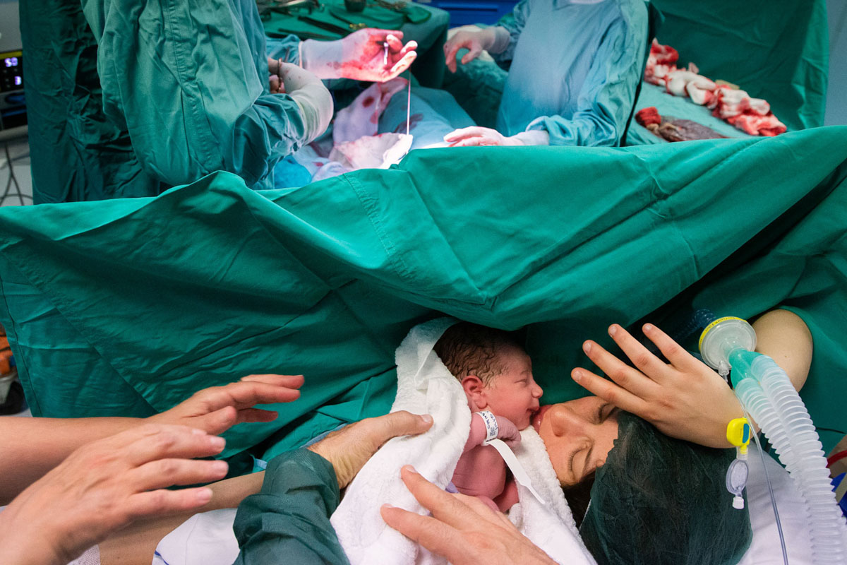 mamma che tocca per la prima volta la figlia nata con un parto cesareo