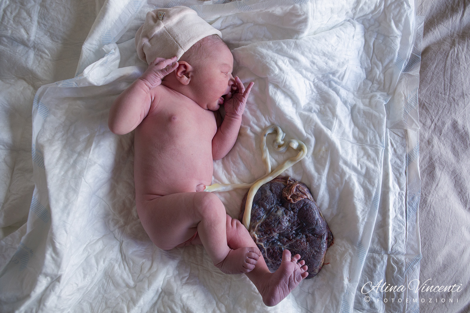Bimba con la placenta ancora attaccata